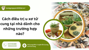 cách điều trị u xơ tử cung tại nhà