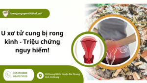 U xơ tử cung bị rong kinh
