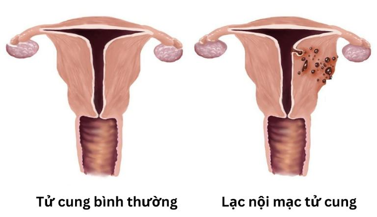 Lạc nội mạc tự cung
