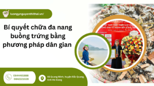 Chữa đa nang buồng trứng bằng phương pháp dân gian