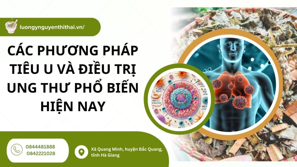 Các cách tiêu u phổ biến
