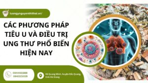 Các cách tiêu u phổ biến