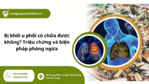 Bị khối u phổi có chữa được không? Triệu chứng và biện pháp phòng ngừa