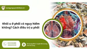 Khối u ở phổi có nguy hiểm không? Cách điều trị u phổi