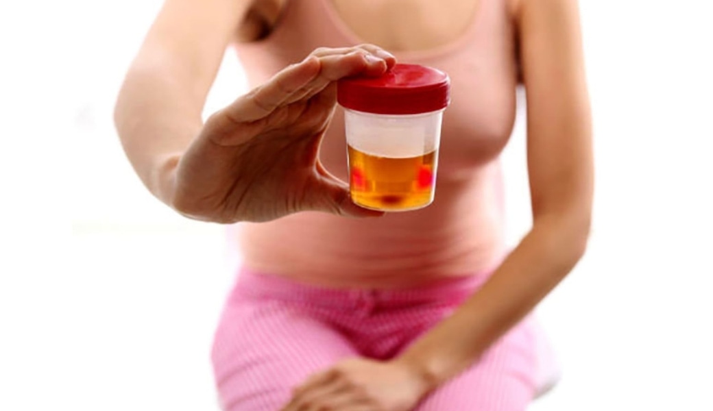 Tiểu ra máu có gây nguy hiểm không?