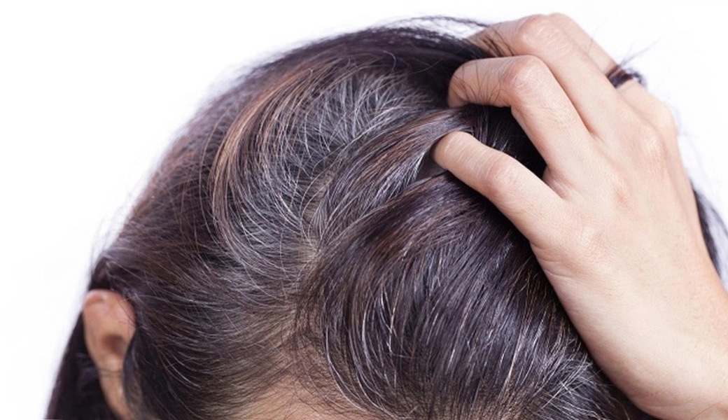 Tóc bạc sớm khiến bạn mất tự tin về vẻ bên ngoài