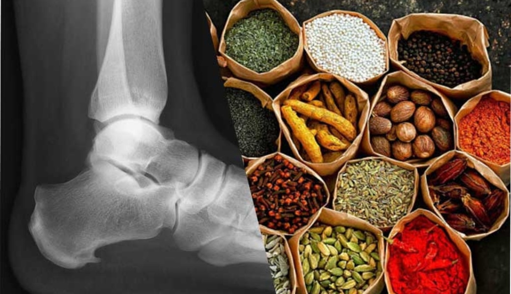 Trị gai gót chân bằng thuốc nam hiệu quả, an toàn