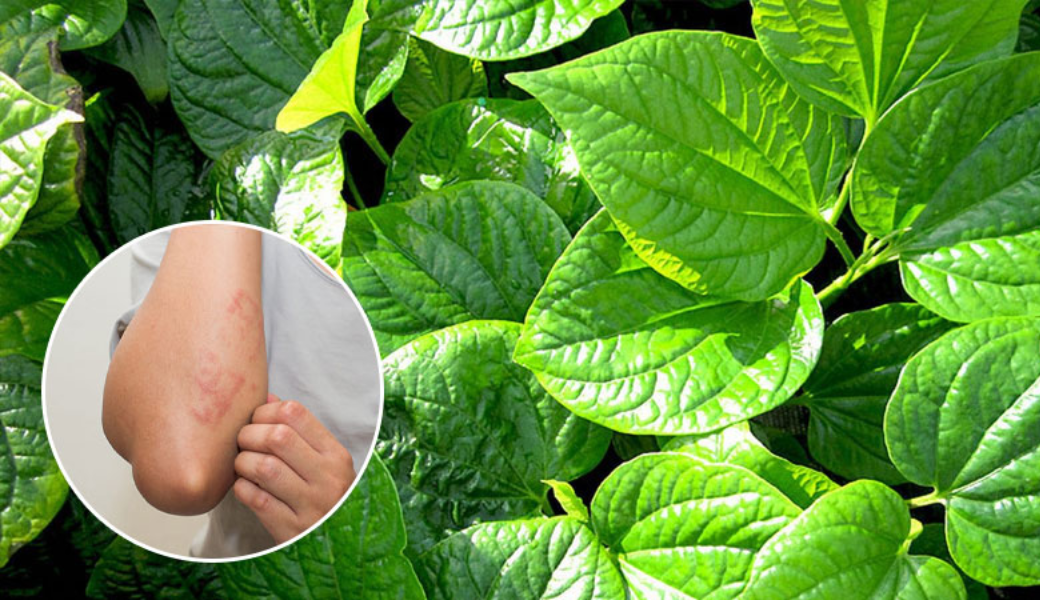 tắm nước lá gì để hết ngứa