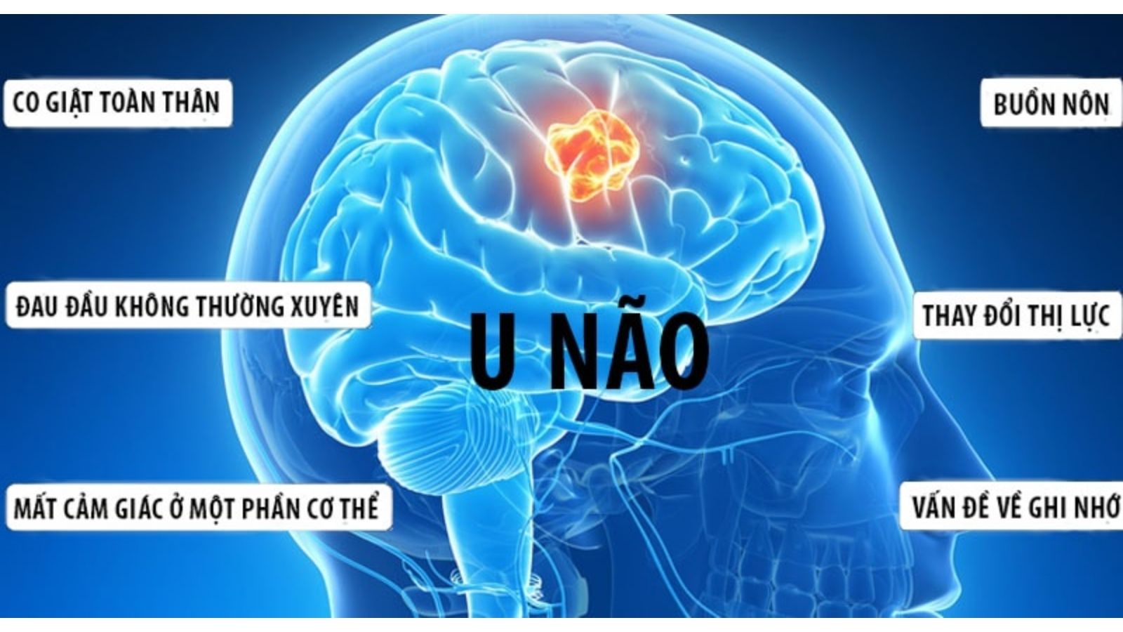 cay-thuoc-nam-chua-benh-u-nao