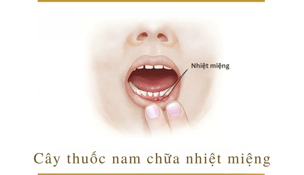 cay-thuoc-nam-chua-nhiet-mieng