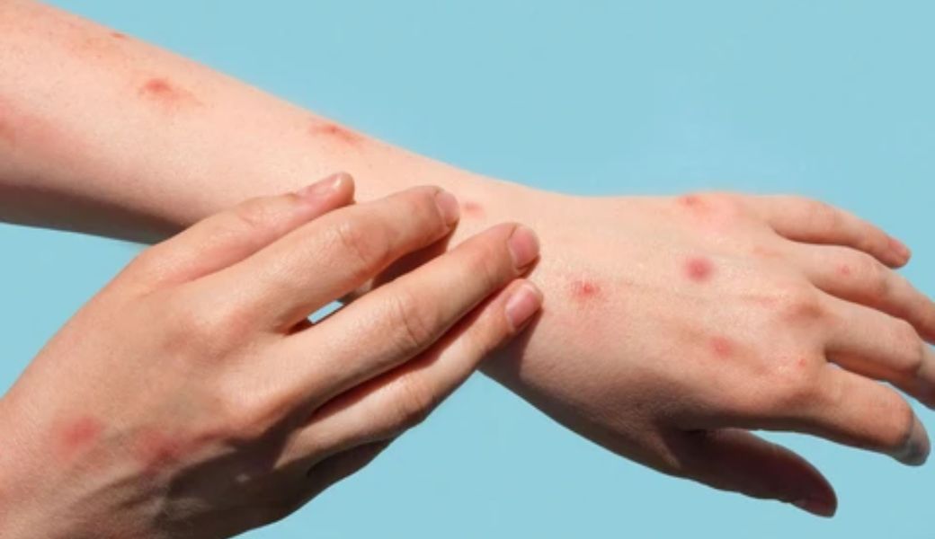 thuoc-nam-chua-thuy-dau