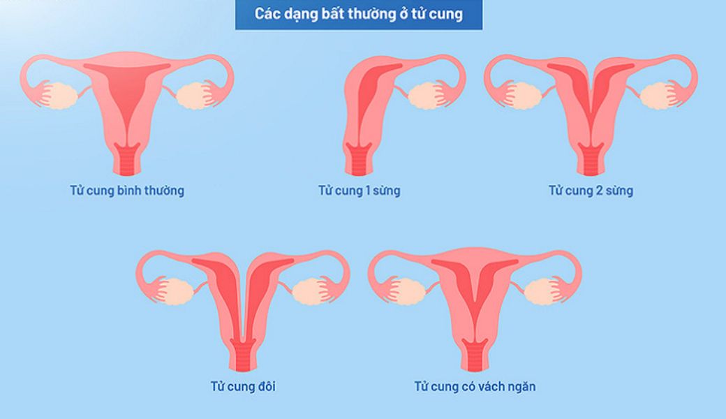 vo-sinh-nguyen-phat-co-chua-duoc-khong