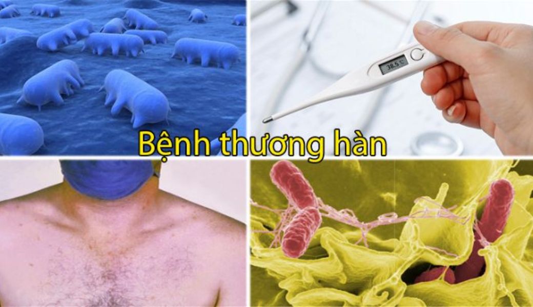 cay-huoc-nam-chua-benh-thuong-han