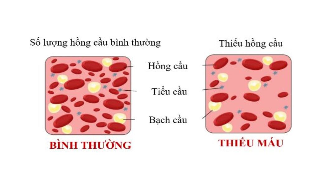 cay-thuoc-nam-bo-mau