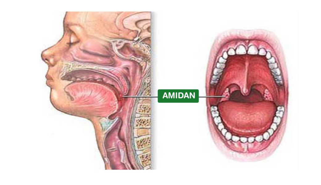 chua-amidan-bang-thuoc-nam