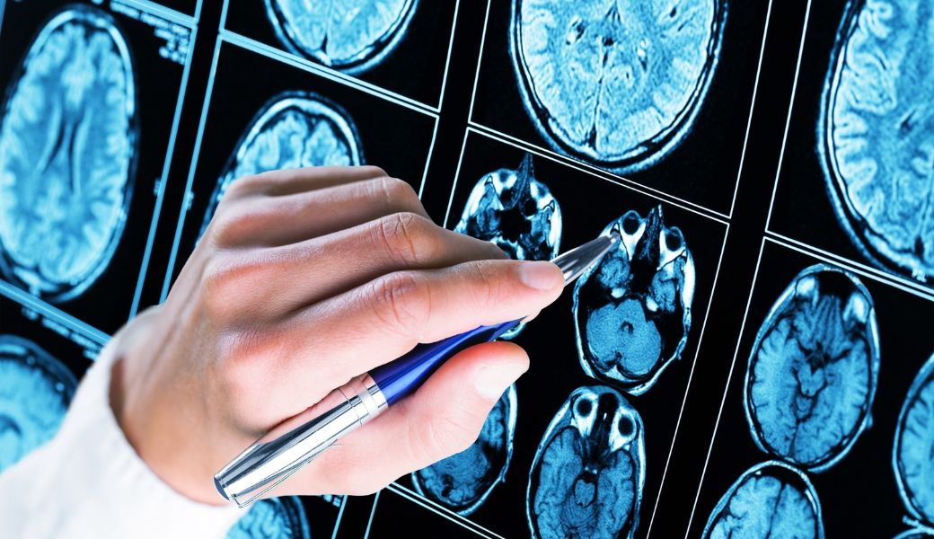 nhung-bai-thuoc-nam-chua-benh-dong-kinh