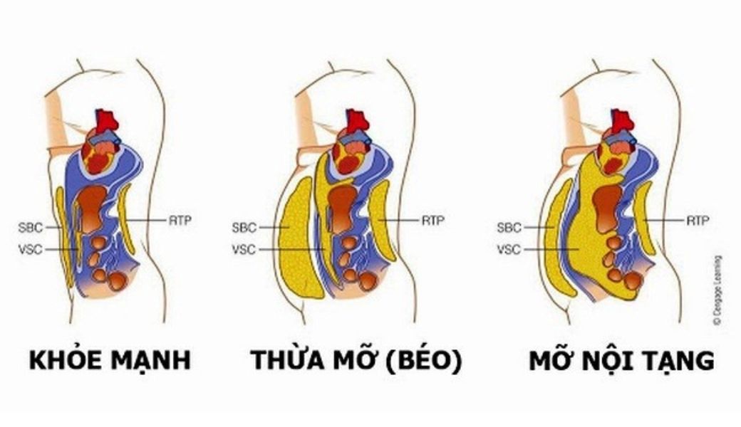 thuoc-nam-giam-mo-noi-tang
