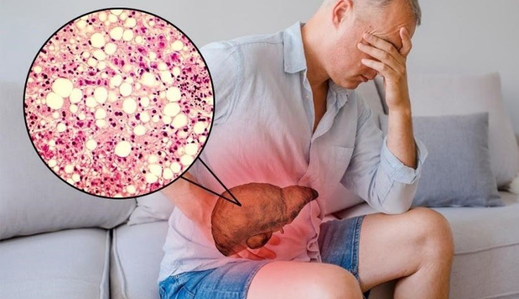 thuoc-nam-tri-men-gan-cao