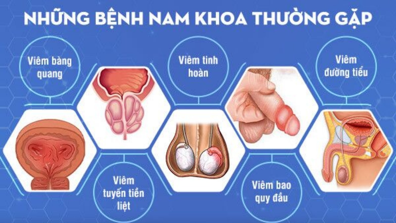 Rối loạn cương dương ở nam giới