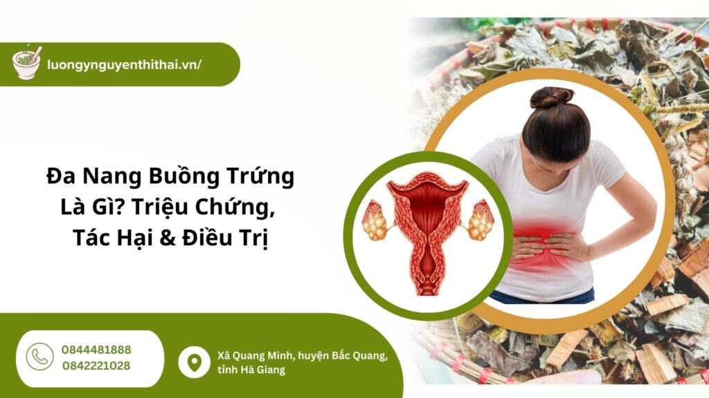 đa nang buồng trứng là gì