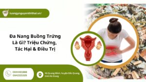 đa nang buồng trứng là gì
