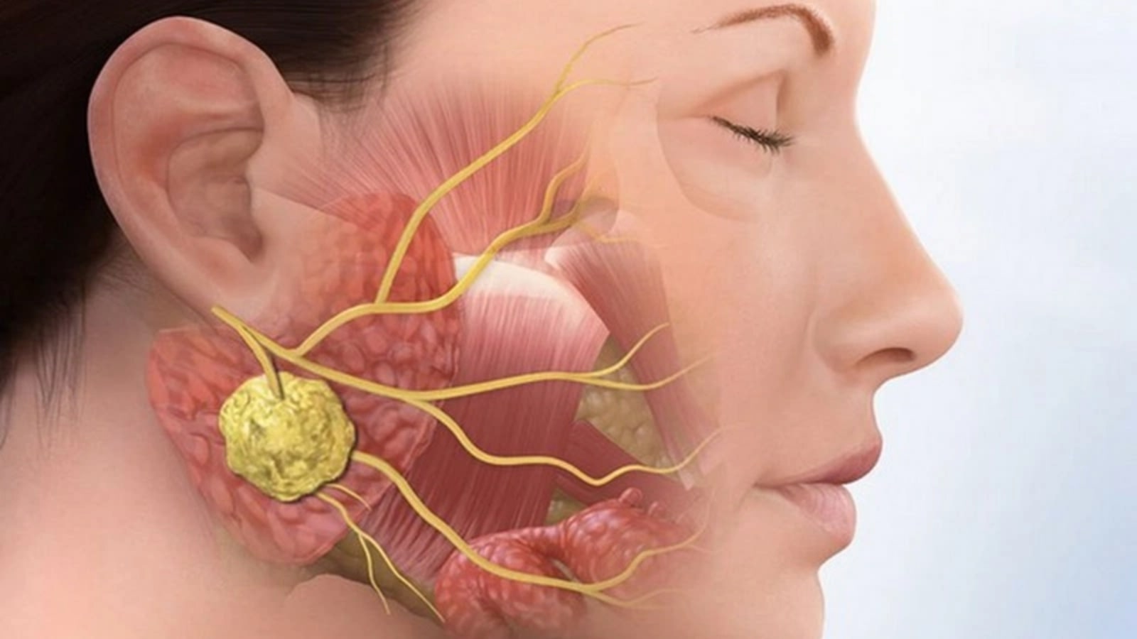 giải đáp nữ bị quai bị có vô sinh không​