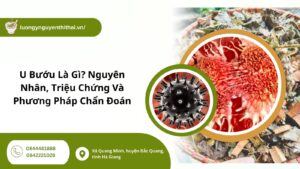 u bướu là gì