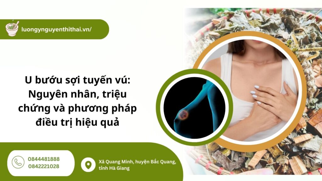 u bướu sợi tuyến