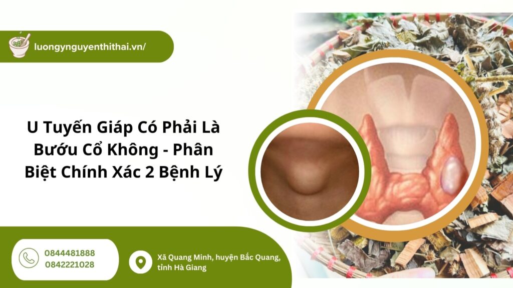u tuyến giáp có phải là bướu cổ không