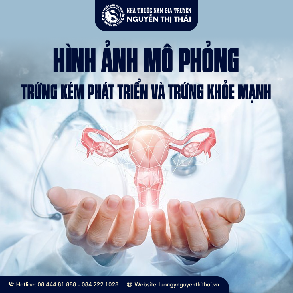 “Trứng lép: nang noãn không phát triển đến giai đoạn rụng trứng.”