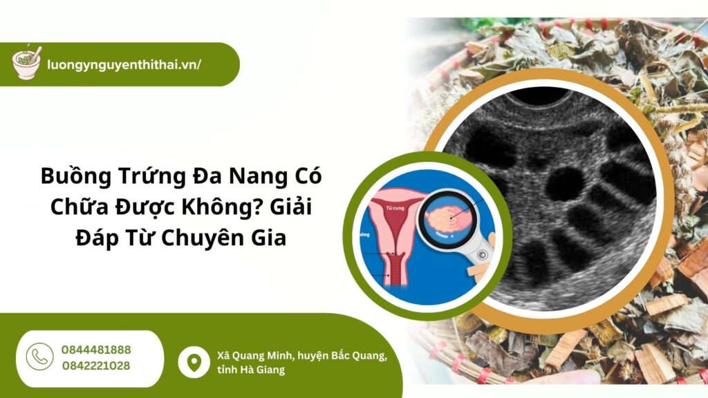 buồng trứng đa nang có chữa được không