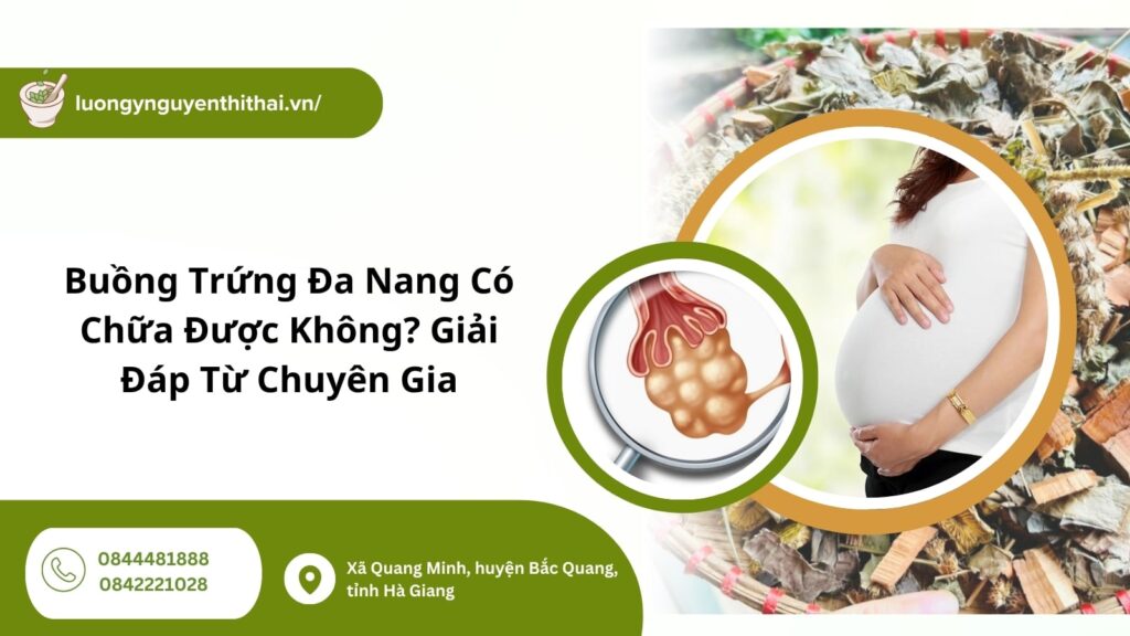 buồng trứng đa nang làm sao để có con