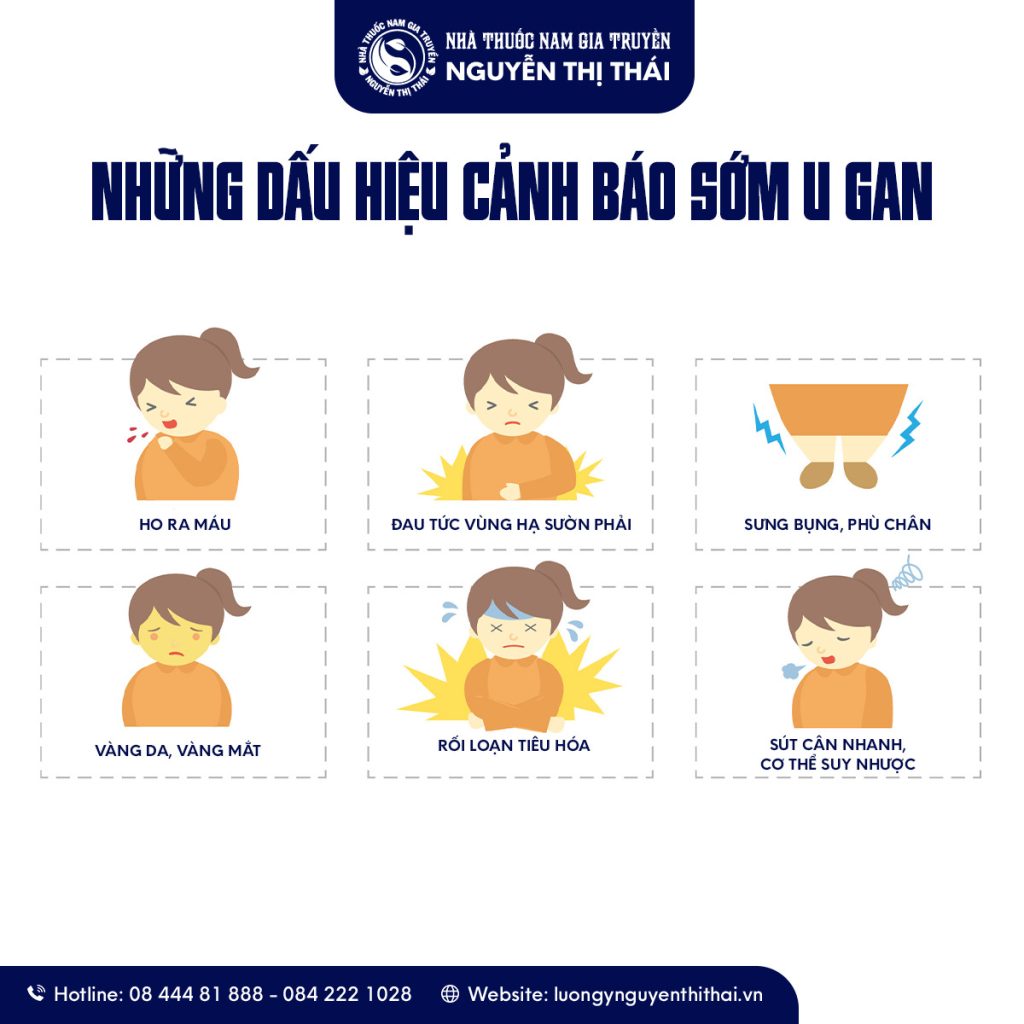 Những dấu hiệu cảnh báo sớm của bệnh u gan – hãy đi khám sớm để bảo vệ sức khỏe gan.