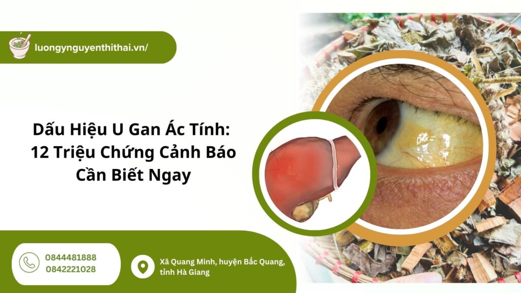 Dấu Hiệu U Gan Ác Tính