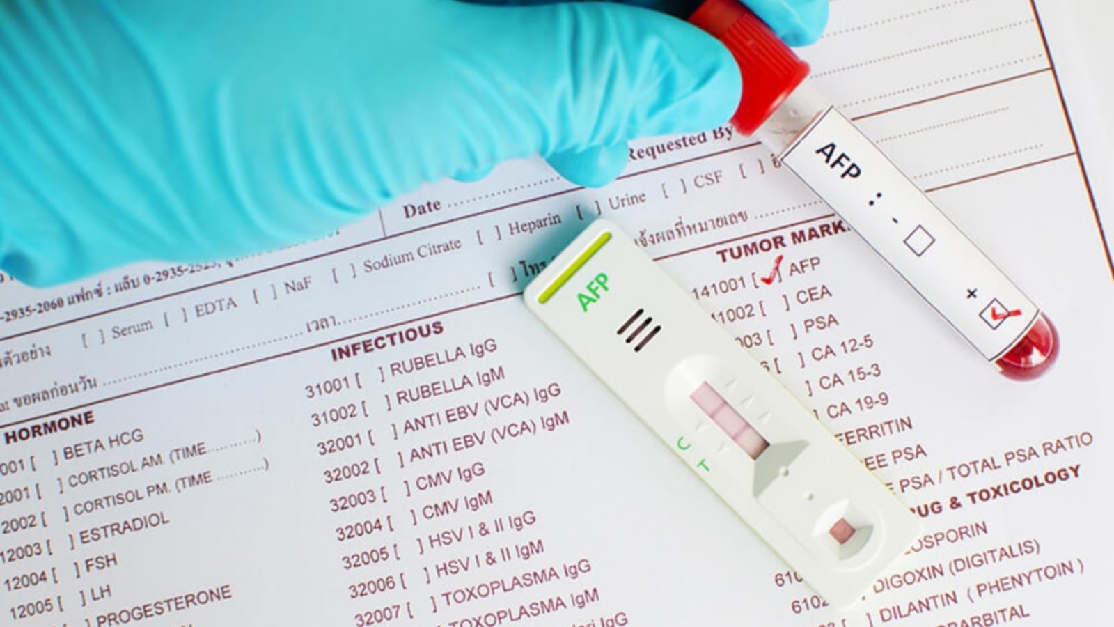 Dấu Hiệu U Gan Ác Tính