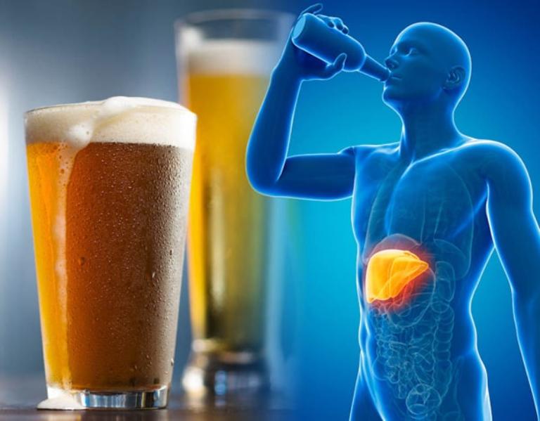 Kiểm soát viêm gan siêu vi, rượu bia, béo phì và bệnh lý đi kèm