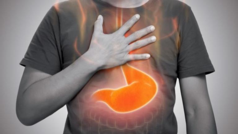 Dấu hiệu gợi ý u dạ dày ác tính