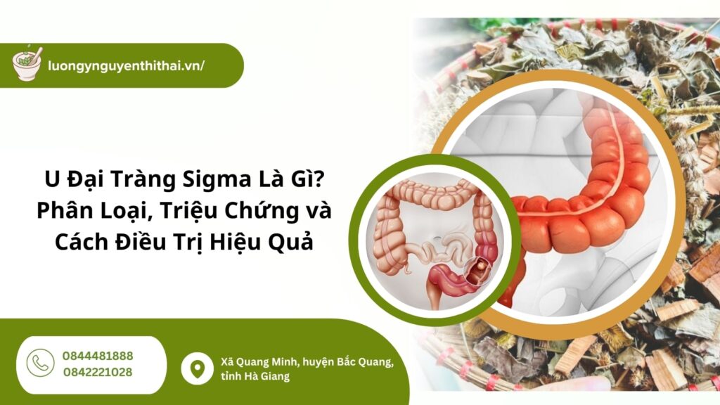 U Đại Tràng Sigma Là Gì