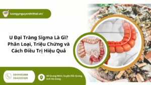 U Đại Tràng Sigma Là Gì