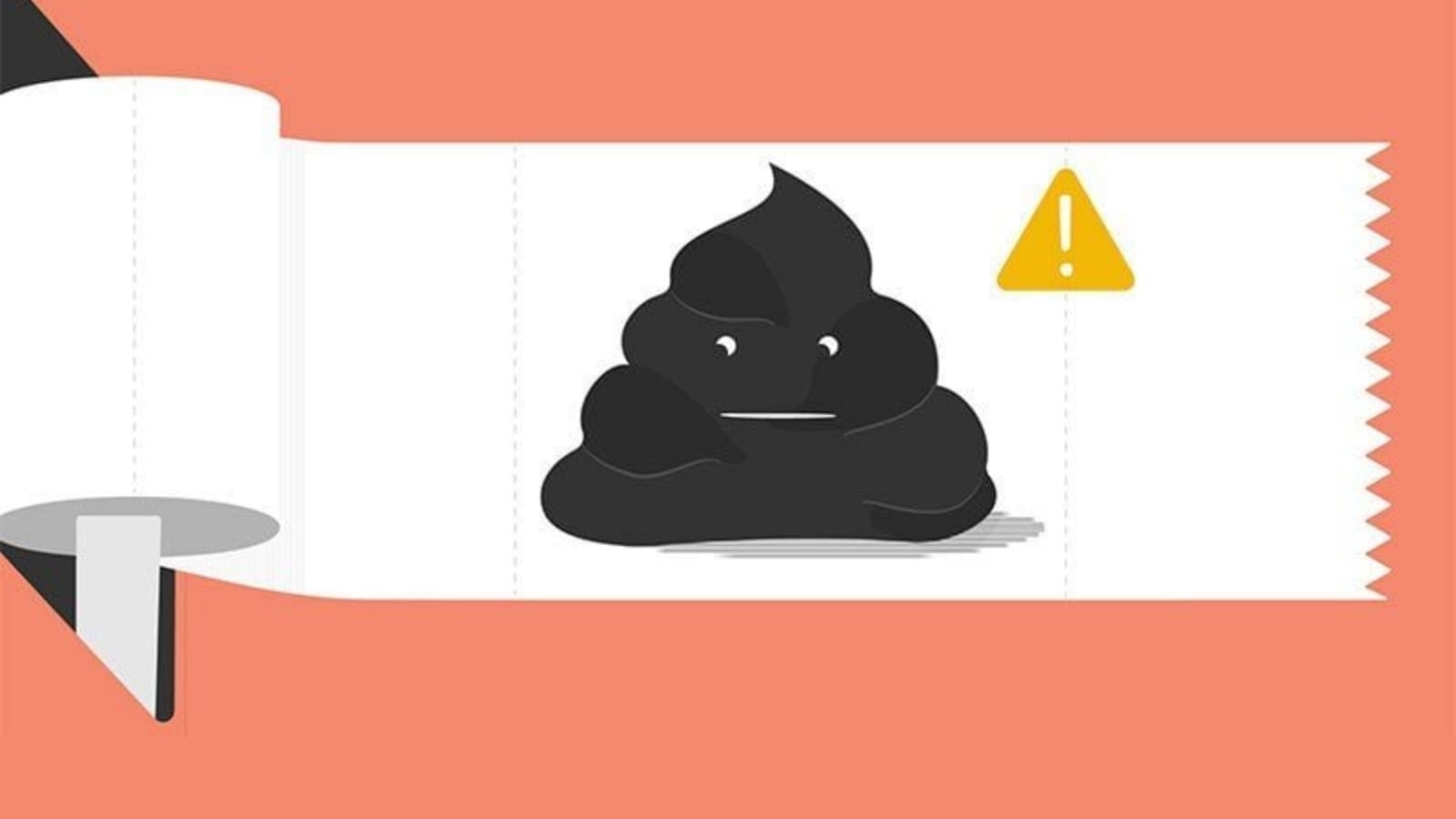 U Đại Tràng Sigma Là Gì