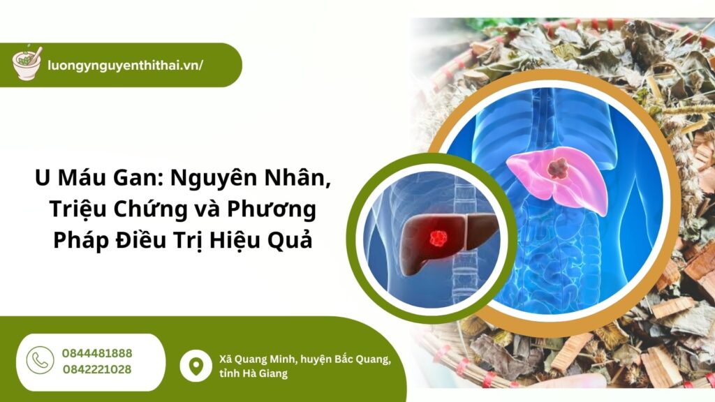 u máu gan