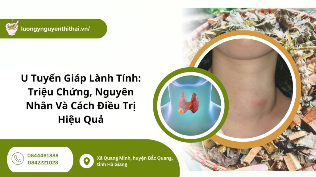 u tuyến giáp lành tính