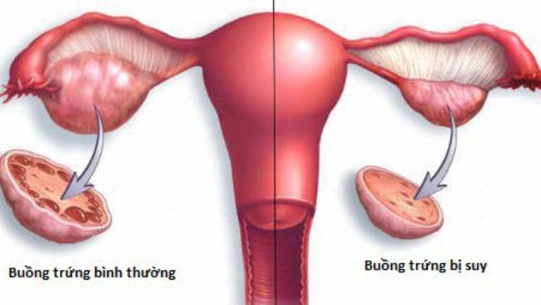 Chất lượng trứng bị giảm sút
